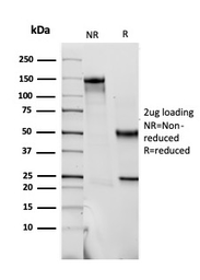 Anti-S100 beta antibody [SPM354] used in  (). GTX04512