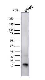 Anti-S100 beta antibody [SPM354] used in Western Blot (WB). GTX04512