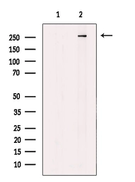 Anti-MAP1A antibody used in Western Blot (WB). GTX04514