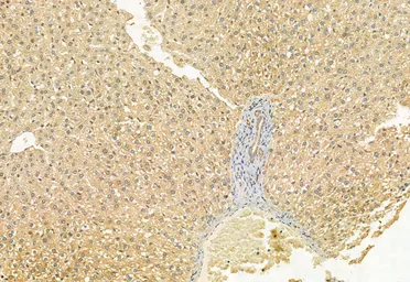 Anti-MCD antibody used in IHC (Paraffin sections) (IHC-P). GTX04518