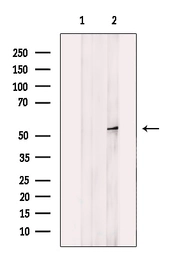 Anti-MCD antibody used in Western Blot (WB). GTX04518