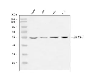 Anti-KLF10 antibody used in Western Blot (WB). GTX04519