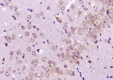 Anti-Dopamine Transporter antibody used in IHC (Paraffin sections) (IHC-P). GTX04526