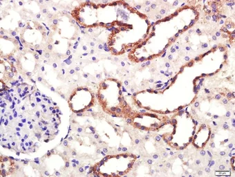 Anti-Dopamine Transporter antibody used in IHC (Paraffin sections) (IHC-P). GTX04526