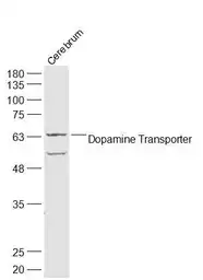 Anti-Dopamine Transporter antibody used in Western Blot (WB). GTX04526