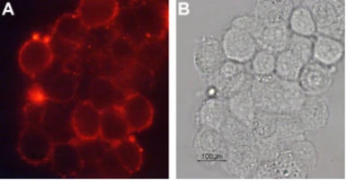 Anti-Dopamine Transporter antibody used in Immunocytochemistry/ Immunofluorescence (ICC/IF). GTX04527