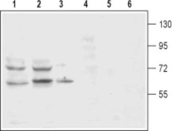 Anti-Dopamine Transporter antibody used in Western Blot (WB). GTX04527