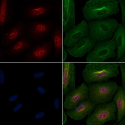 Anti-PAD4 antibody used in Immunocytochemistry/ Immunofluorescence (ICC/IF). GTX04531