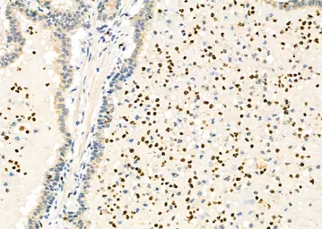 Anti-PAD4 antibody used in IHC (Paraffin sections) (IHC-P). GTX04531