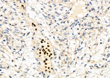 Anti-PAD4 antibody used in IHC (Paraffin sections) (IHC-P). GTX04531