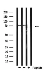 Anti-PAD4 antibody used in Western Blot (WB). GTX04531