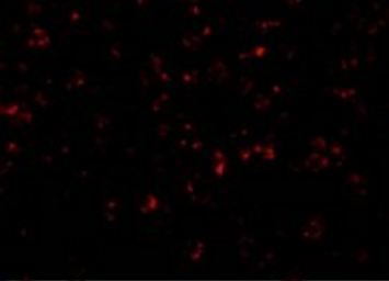 Anti-NALP1 antibody used in Immunocytochemistry/ Immunofluorescence (ICC/IF). GTX04532