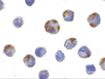 Anti-NALP1 antibody used in IHC-P (cell pellet) (IHC-P (cell pellet)). GTX04532