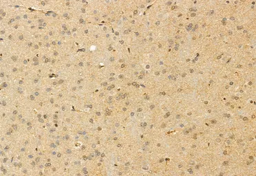 Anti-FAM38A antibody used in IHC (Paraffin sections) (IHC-P). GTX04534