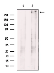 Anti-FAM38A antibody used in Western Blot (WB). GTX04534