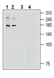 Anti-FAM38B antibody used in Western Blot (WB). GTX04536