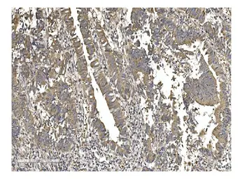 Anti-Gasdermin D antibody used in IHC (Paraffin sections) (IHC-P). GTX04537