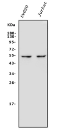 Anti-Gasdermin D antibody used in Western Blot (WB). GTX04537