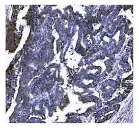 Anti-Gasdermin D antibody [6D11] used in IHC (Paraffin sections) (IHC-P). GTX04538
