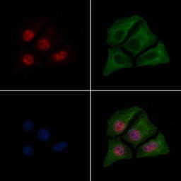 Anti-NFkB p65 (phospho Ser276) antibody used in Immunocytochemistry/ Immunofluorescence (ICC/IF). GTX04541