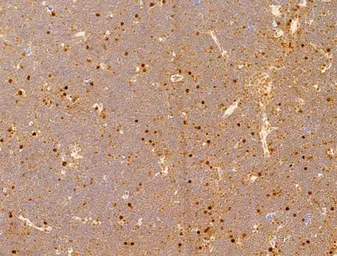Anti-NFkB p65 (phospho Ser276) antibody used in IHC (Paraffin sections) (IHC-P). GTX04541