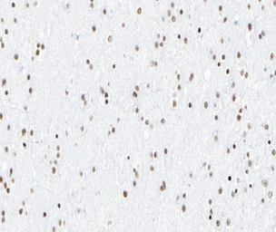 Anti-NFkB p65 (phospho Ser276) antibody used in IHC (Paraffin sections) (IHC-P). GTX04541