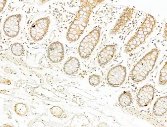 Anti-NFkB p65 (phospho Ser276) antibody used in IHC (Paraffin sections) (IHC-P). GTX04541