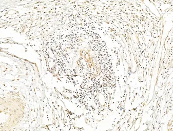 Anti-NFkB p65 (phospho Ser276) antibody used in IHC (Paraffin sections) (IHC-P). GTX04541