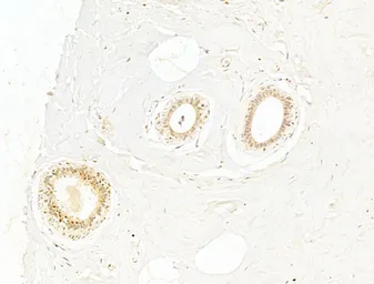 Anti-NFkB p65 (phospho Ser276) antibody used in IHC (Paraffin sections) (IHC-P). GTX04541