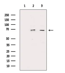 Anti-NFkB p65 (phospho Ser276) antibody used in Western Blot (WB). GTX04541