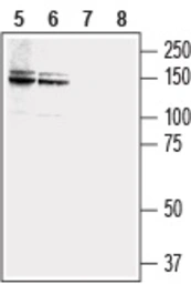Anti-NCAM2 antibody used in Western Blot (WB). GTX04542