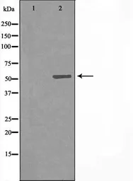 Anti-CYP7B1 antibody used in Western Blot (WB). GTX04543