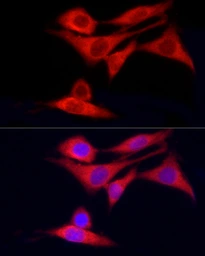 Anti-CYP7B1 antibody used in Immunocytochemistry/ Immunofluorescence (ICC/IF). GTX04545