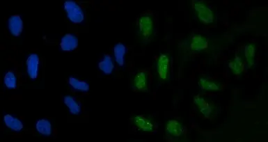 Anti-GLIS1 antibody used in Immunocytochemistry/ Immunofluorescence (ICC/IF). GTX04548