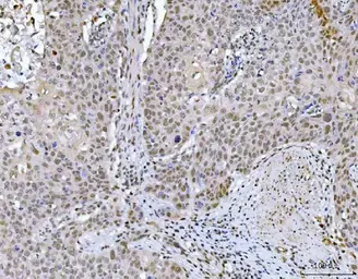 Anti-GLIS1 antibody used in IHC (Paraffin sections) (IHC-P). GTX04548