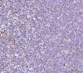 Anti-GLIS1 antibody used in IHC (Paraffin sections) (IHC-P). GTX04548