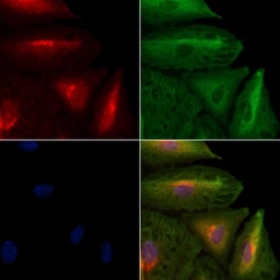 Anti-IL1F8 antibody used in Immunocytochemistry/ Immunofluorescence (ICC/IF). GTX04549