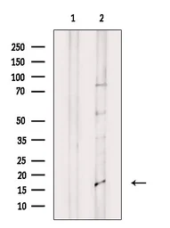 Anti-IL1F8 antibody used in Western Blot (WB). GTX04549