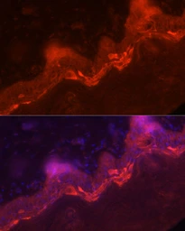 Anti-IL1F9 antibody used in IHC (Paraffin sections) (IHC-P). GTX04550