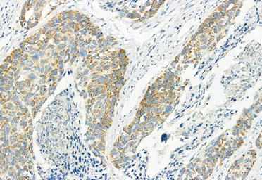 Anti-LGR5 antibody used in IHC (Paraffin sections) (IHC-P). GTX04555