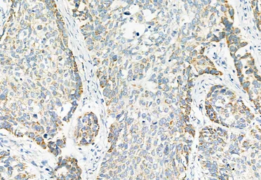 Anti-LGR5 antibody used in IHC (Paraffin sections) (IHC-P). GTX04555
