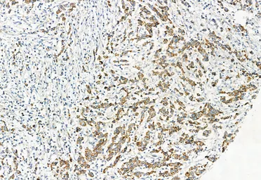 Anti-LGR5 antibody used in IHC (Paraffin sections) (IHC-P). GTX04555