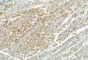 Anti-LGR5 antibody used in IHC (Paraffin sections) (IHC-P). GTX04555