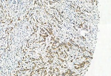 Anti-LGR5 antibody used in IHC (Paraffin sections) (IHC-P). GTX04555