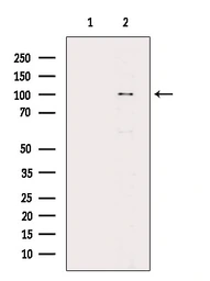 Anti-LGR5 antibody used in Western Blot (WB). GTX04555