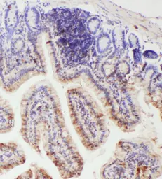 Anti-IL18 antibody used in IHC (Paraffin sections) (IHC-P). GTX04558