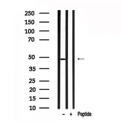 Anti-SP7 antibody used in Western Blot (WB). GTX04567