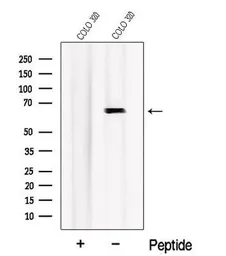 Anti-Nurr1 antibody used in Western Blot (WB). GTX04568