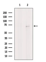 Anti-Nurr1 antibody used in Western Blot (WB). GTX04568