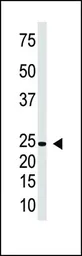 Anti-IL29 antibody used in Western Blot (WB). GTX04572